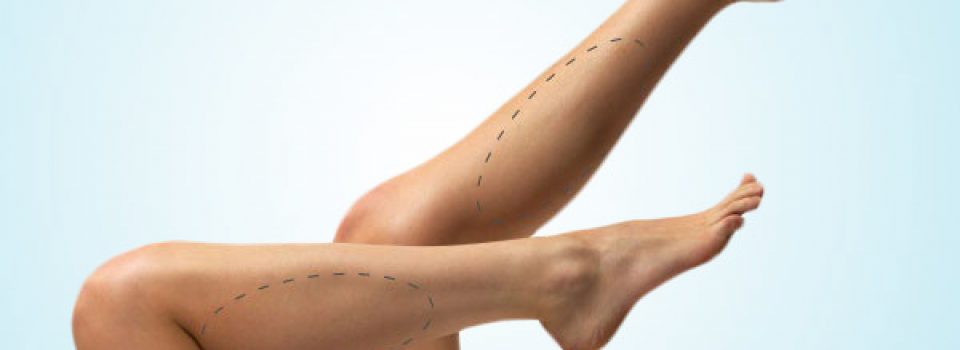 Augmentation des mollets en Tunisie